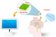 Interface Neuronale Directe